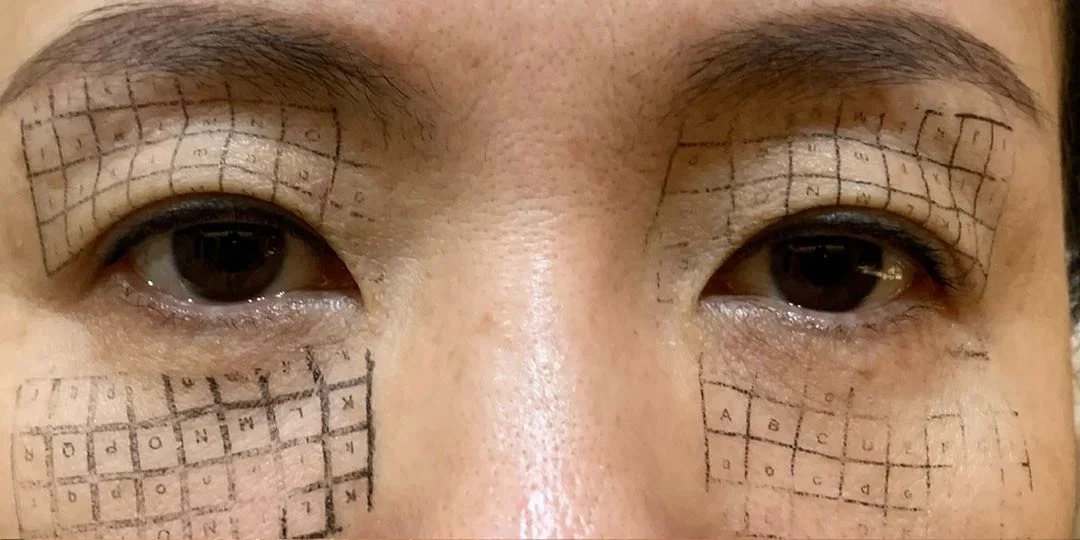 Thermage FLX — before